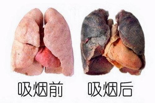 无烟日宣传资料_烟的宣传标语_宣传烟的广告