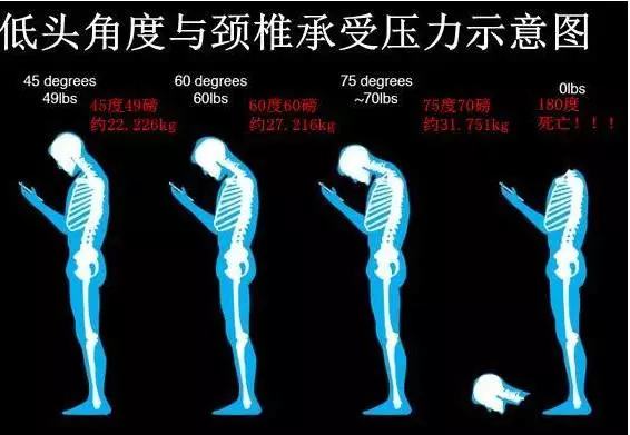 适合颈椎病玩的游戏手机_颈椎病适合玩手机游戏吗_颈椎病可以玩手机吗