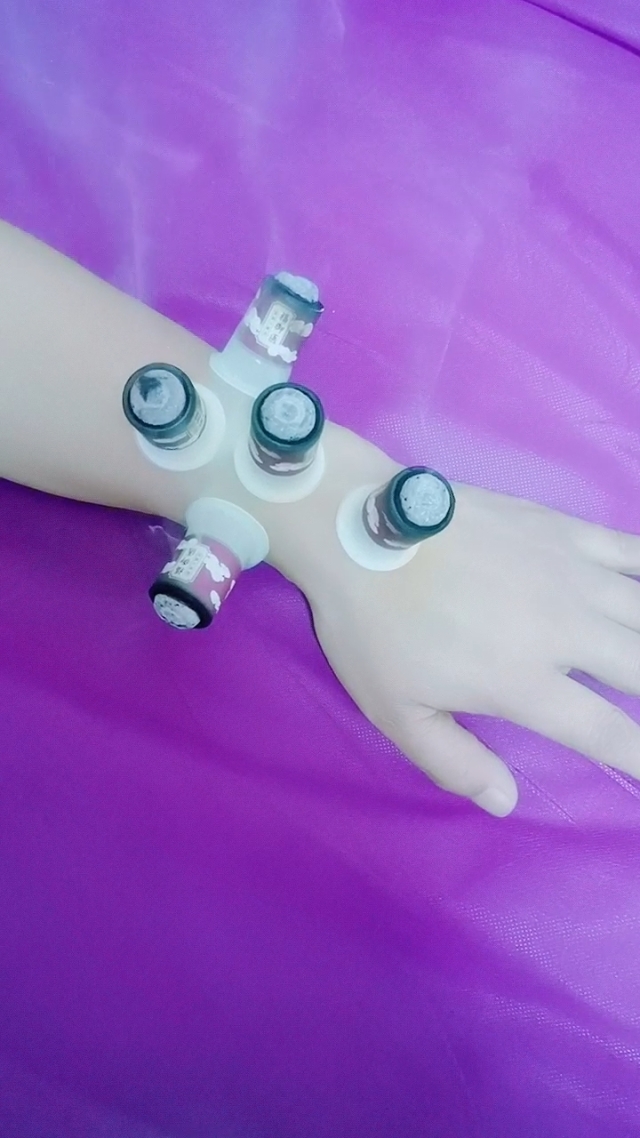打手游打的手腕疼_手腕原因痛打手机游戏会痛吗_手机打游戏手腕痛什么原因