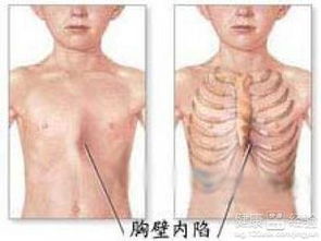 女生鸡胸游戏,女生鸡胸游戏的趣味体验